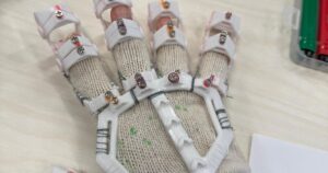 Orthodic Hand Glove with RubberBands by Saad Caffeine | Download free STL model